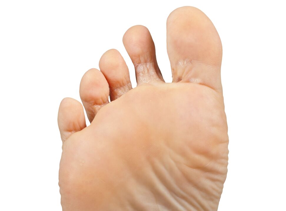 Funger-Good et Pair and Hectic-Cream-Demyxil